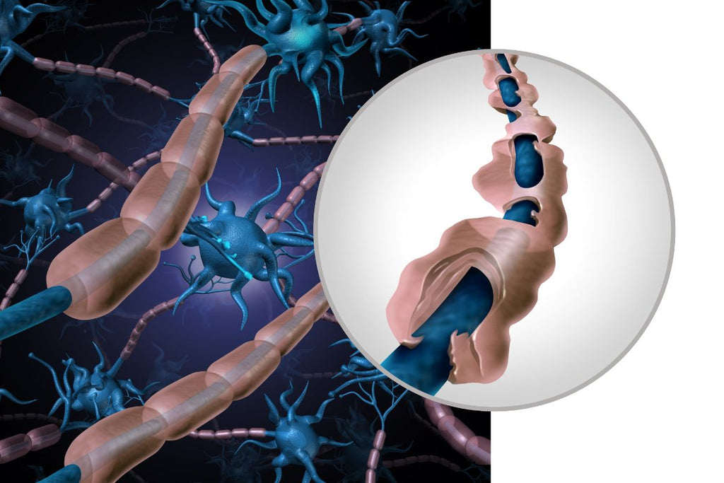 Multiple Sclerosis ICD-10